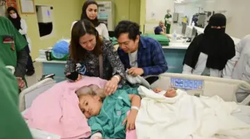 صحيفة المرصد – “الربيعة” يوضح تفاصيل عملية فصل التوأم الملتصق الفلبيني “كليا وموريس آن”.. ويحدد نسبة الخطر!